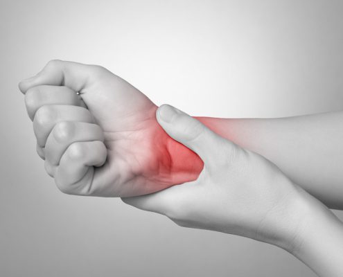 fractura muneca accidente trabajo